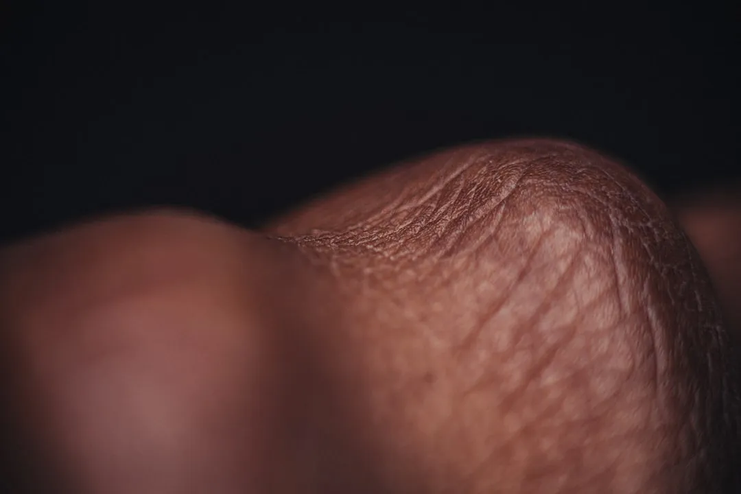 Foto de corra de pela humana Foto de corra de pela humana