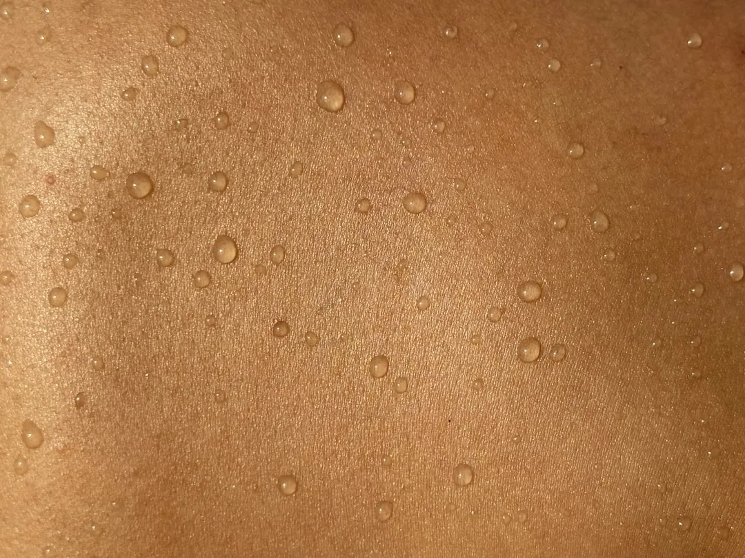 As costas de um homem com muitas pintas, uma área que necessita de monitoramento dermatológico. As costas de um homem com muitas pintas, uma área que necessita de monitoramento dermatológico.