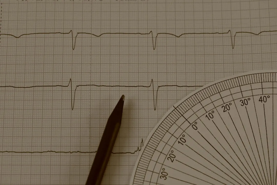 Rastreamento de eletrocardiograma com lápis e transferidor Rastreamento de eletrocardiograma com lápis e transferidor