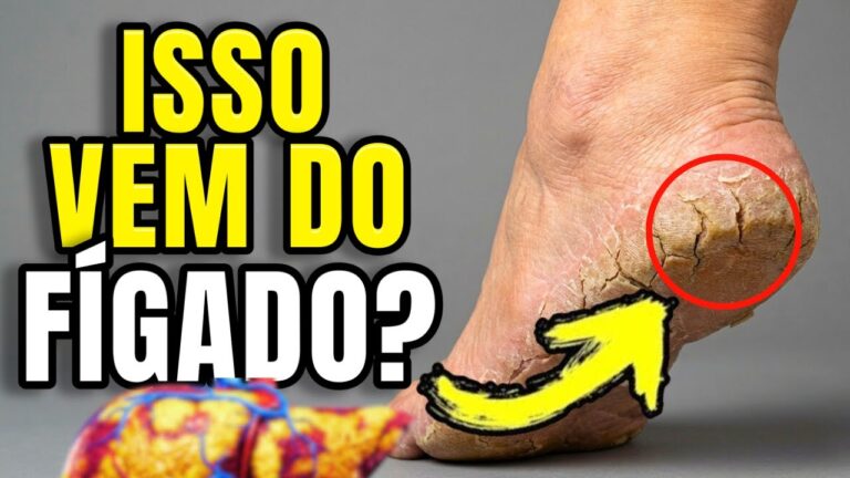FÍGADO MORRENDO: O SINAL NO SEU PÉ QUE PODE SALVAR SUA VIDA!