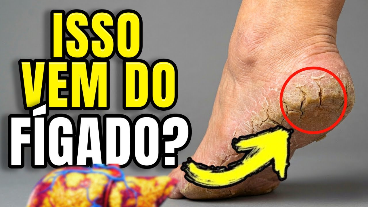 FÍGADO MORRENDO: O SINAL NO SEU PÉ QUE PODE SALVAR SUA VIDA!