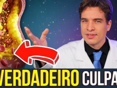 O alimento que MAIS entope artérias NÃO é o que você pensa (PARE de comer AGORA)