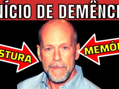 6 SINAIS INICIAIS de DEMÊNCIA que você NUNCA PODE IGNORAR! Sintomas SILENCIOSOS de ALZHEIMER