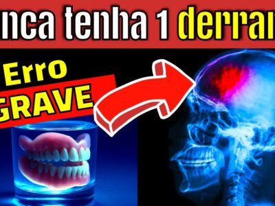 COMO EVITAR UM AVC TODAS AS MANHÃS | 7 HÁBITOS que NEUROLOGISTAS SEGUEM