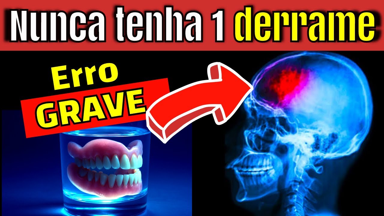 COMO EVITAR UM AVC TODAS AS MANHÃS | 7 HÁBITOS que NEUROLOGISTAS SEGUEM