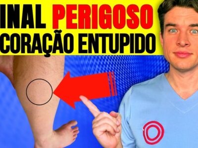 6 Sinais de Artéria Entupida que Muitos IGNORAM (Alerta de Cardiologista)