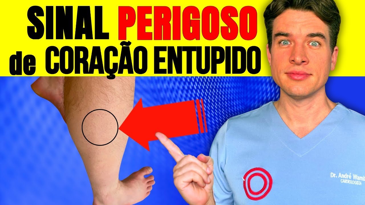 6 Sinais de Artéria Entupida que Muitos IGNORAM (Alerta de Cardiologista)