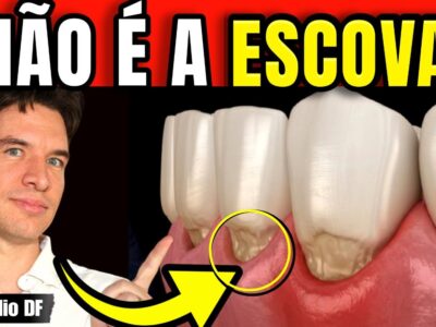 Sua gengiva NÃO retraiu por escovar forte: É um alerta do seu CORAÇÃO.