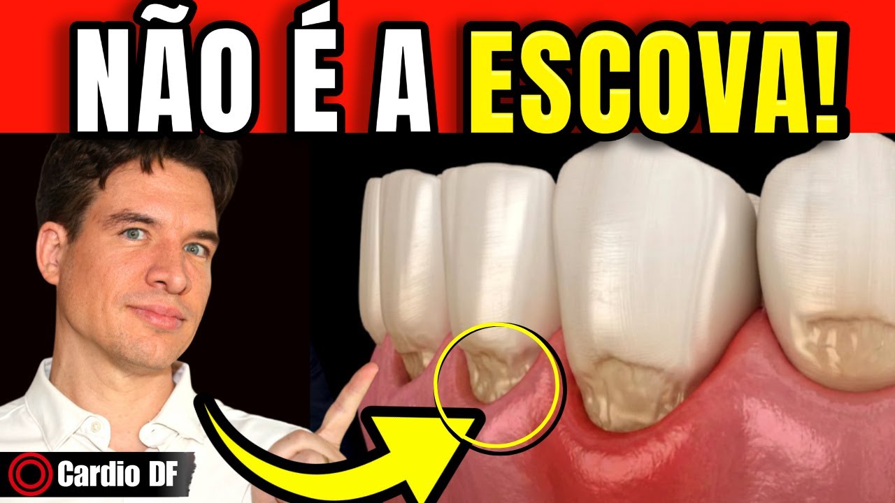Sua gengiva NÃO retraiu por escovar forte: É um alerta do seu CORAÇÃO.