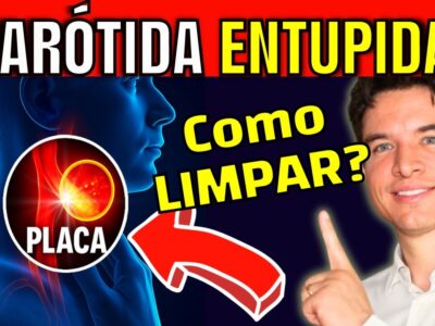 PLACA NA CARÓTIDA: 7 PASSOS URGENTES PARA LIMPAR SUAS ARTÉRIAS E EVITAR UM DERRAME (AVC)