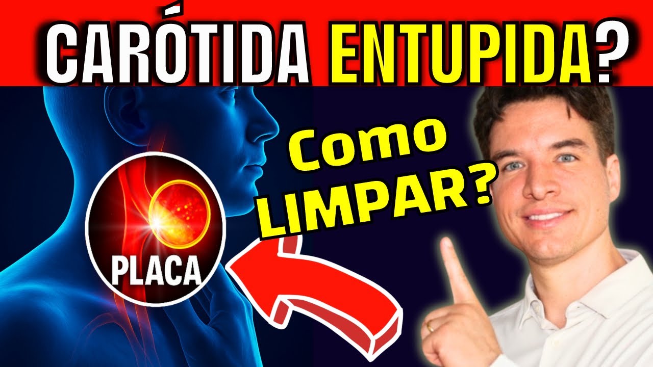 PLACA NA CARÓTIDA: 7 PASSOS URGENTES PARA LIMPAR SUAS ARTÉRIAS E EVITAR UM DERRAME (AVC)