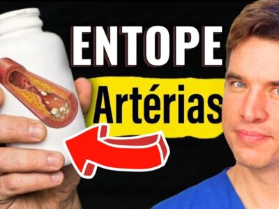 Alerta! ESTE suplemento da moda está DANIFICANDO suas artérias