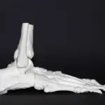 Recuperação de lesões ortopédicas com apps