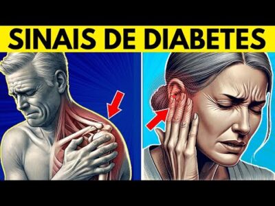 7 sinais surpreendentes de diabetes que você pode estar ignorando!