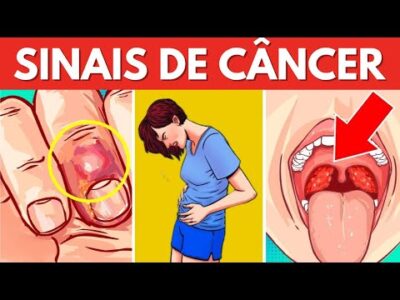 15 Sinais De Câncer Ignorados Principalmente Pelas Mulheres