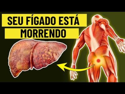 O FÍGADO ESTÁ MORRENDO! 12 Sinais Estranhos de Danos no Fígado