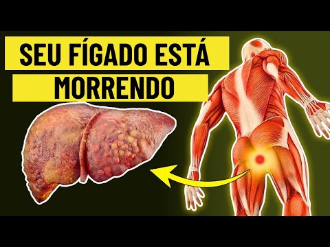 O FÍGADO ESTÁ MORRENDO! 12 Sinais Estranhos de Danos no Fígado