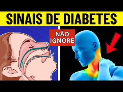 Sinais de DIABETES à NOITE + 8 Dicas Para Evitar Picos de Glicose SEM Cortar Carboidratos