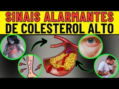 Sinais de que seu colesterol está muito alto!