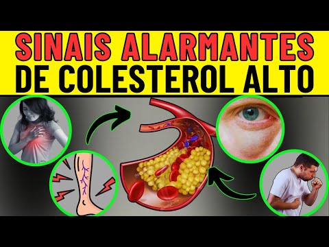 Sinais de que seu colesterol está muito alto!