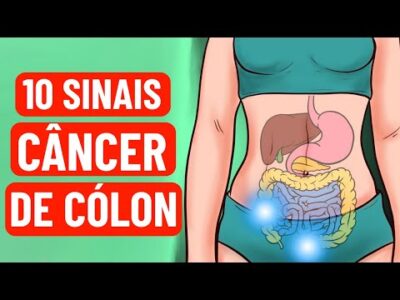 10 sinais de alerta do câncer de cólon
