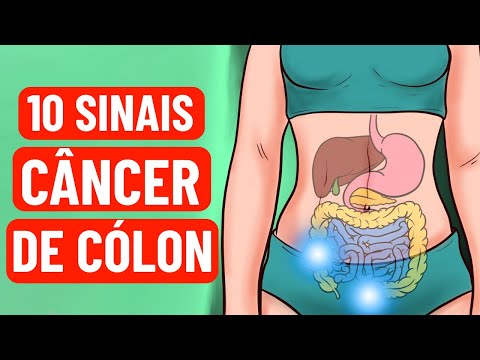 10 sinais de alerta do câncer de cólon