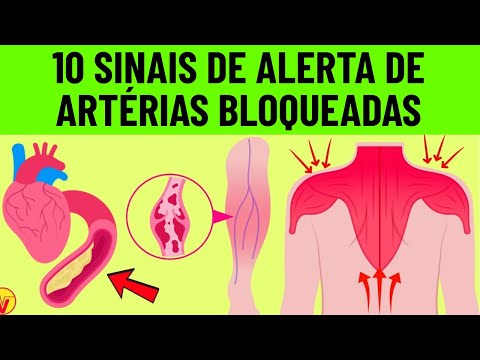 10 sinais de alerta de artérias cardíacas bloqueadas nas pernas e nos pés