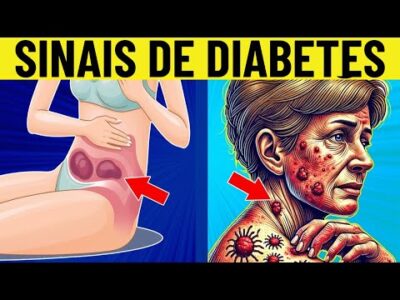 8 SINAIS comuns de diabetes em mulheres!