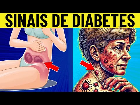 8 SINAIS comuns de diabetes em mulheres!