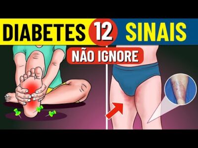 12 Sintomas Incomuns de Diabetes | Sintomas de Diabetes | Diabetes Mellitus