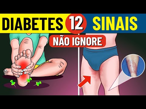 12 Sintomas Incomuns de Diabetes | Sintomas de Diabetes | Diabetes Mellitus