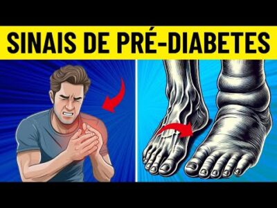 7 sinais dolorosos de pré-diabetes que você deve conhecer!