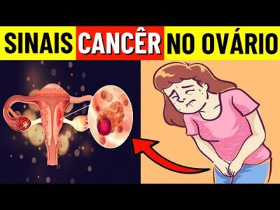9 sinais comuns de câncer de ovário que você nunca deve ignorar