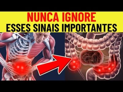 Alerta! 10 Sintomas Silenciosos do Câncer de Cólon (Que Você Ignora)