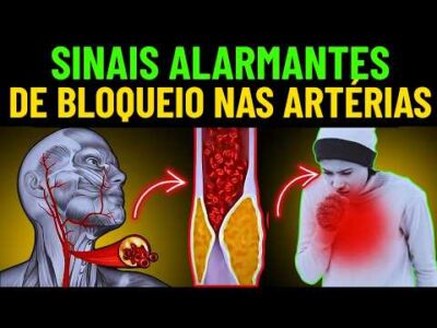 O que Acontece se Você Combinar Estas 5 Vitaminas para Refluxo Ácido?