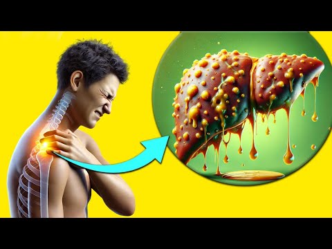 Dor no ombro direito? 💥 É ASSIM QUE SE PARECE O SEU FÍGADO: 8 sinais ESTRANHOS de DANOS NO FÍGADO