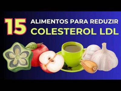 15 alimentos para reduzir os níveis de colesterol LDL