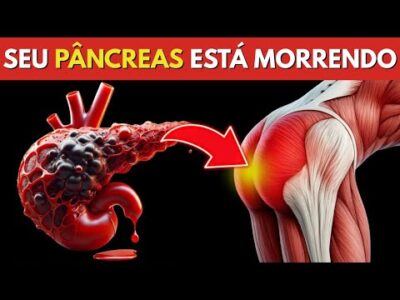 8 Sintomas de CÂNCER DE PÂNCREAS QUE VÃO TE CHOCAR