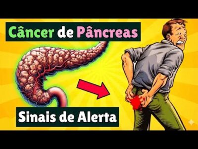 12 Sinais de Alerta de Câncer de Pâncreas Que Vão Te Chocar