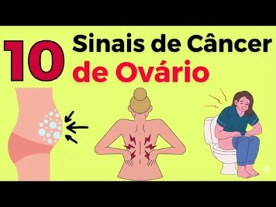 10 sinais comuns de câncer de ovário que você nunca deve ignorar