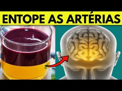 5 alimentos que ENTOPEM as artérias e Causam Infarto