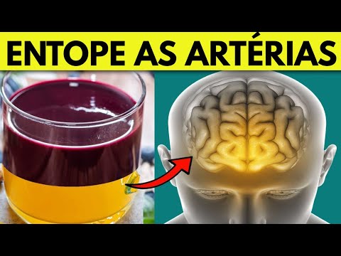 5 alimentos que ENTOPEM as artérias e Causam Infarto