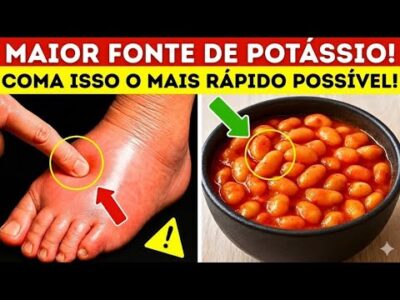 8 Alimentos ricos em potássio que você PRECISA comer para eliminar líquidos RAPIDAMENTE