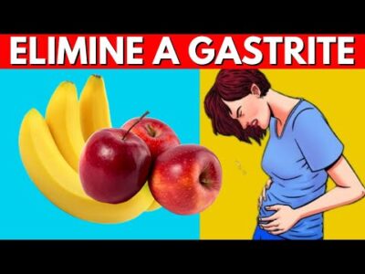 12 Frutas para Aliviar a Gastrite e a Queimação no Estômago