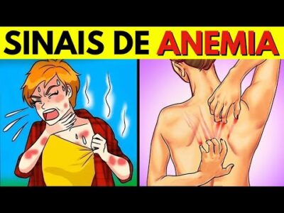 12 Sintomas Silenciosos de ANEMIA que você não deve ignorar