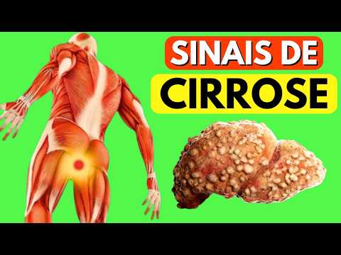 SEU FÍGADO ESTÁ MORRENDO! Os 15 Primeiros Sinais de CIRROSE Hepática que você PRECISA saber