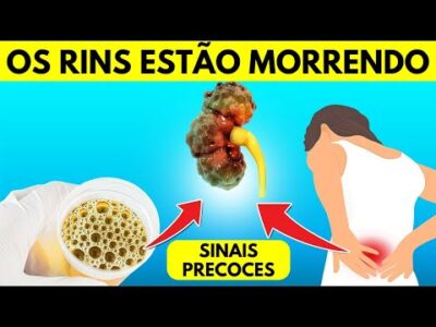 5 sinais precoces de danos renais que você não deve ignorar