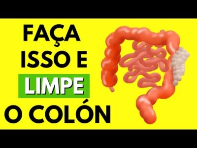 8 Alimentos brancos para Desobstruir seu Cólon rapidamente